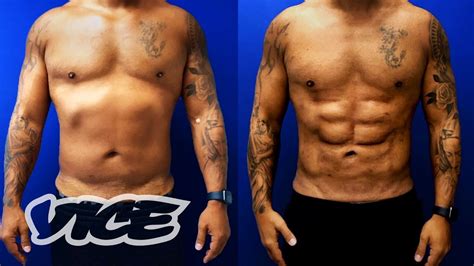 fake abs men|6 pack abs plastic surgery.